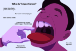 Expert Tongue Cancer Treatment – Dr. Sanjog Singh at Samsara Cancer Care, Nagpur - Services advertisement in Nagpur